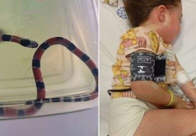 Menina é picada por cobra coral e sofre choque anafilático: “Irreconhecível”, diz mãe