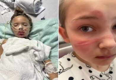 Número de acidentes com explosão de brinquedo em trend viral se multiplica